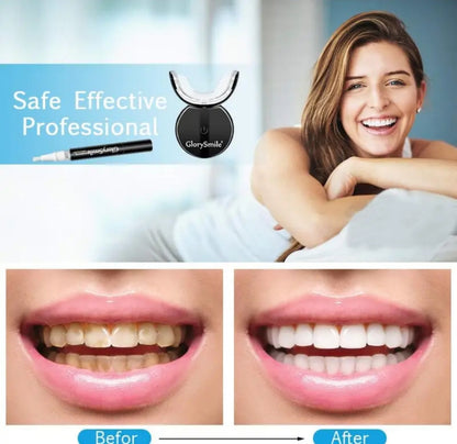 Kit de Blanchiment Dentaire GlorySmile - Souriez avec Confiance en 14 Jours !